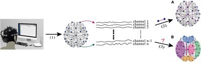 High-order brain functional network for electroencephalography-based diagnosis of major depressive disorder